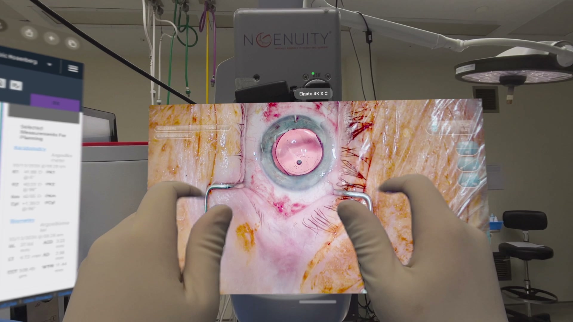 Latex-gloved hands positioning a spatial surgical video within the operating-room view.